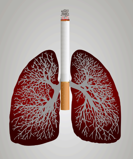 흡연하는 폐 이미지사진