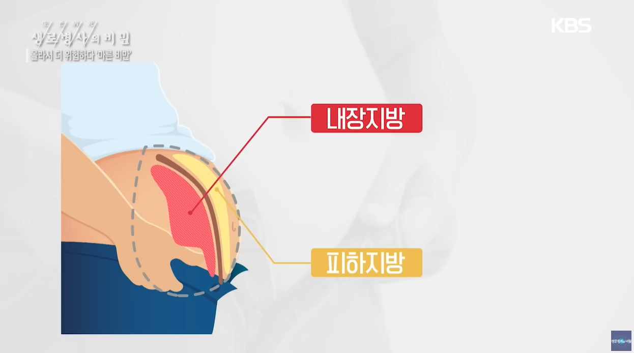 BMI 체질량지수 마른비만 체지방률 내장지방 간식중독 지바간 당뇨병 뇌졸증 수면무호흡 식습관