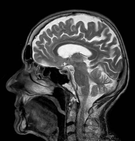 MRI와 MRA의 차이, 활용 사례