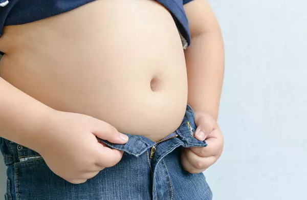 비만 (Obesity)