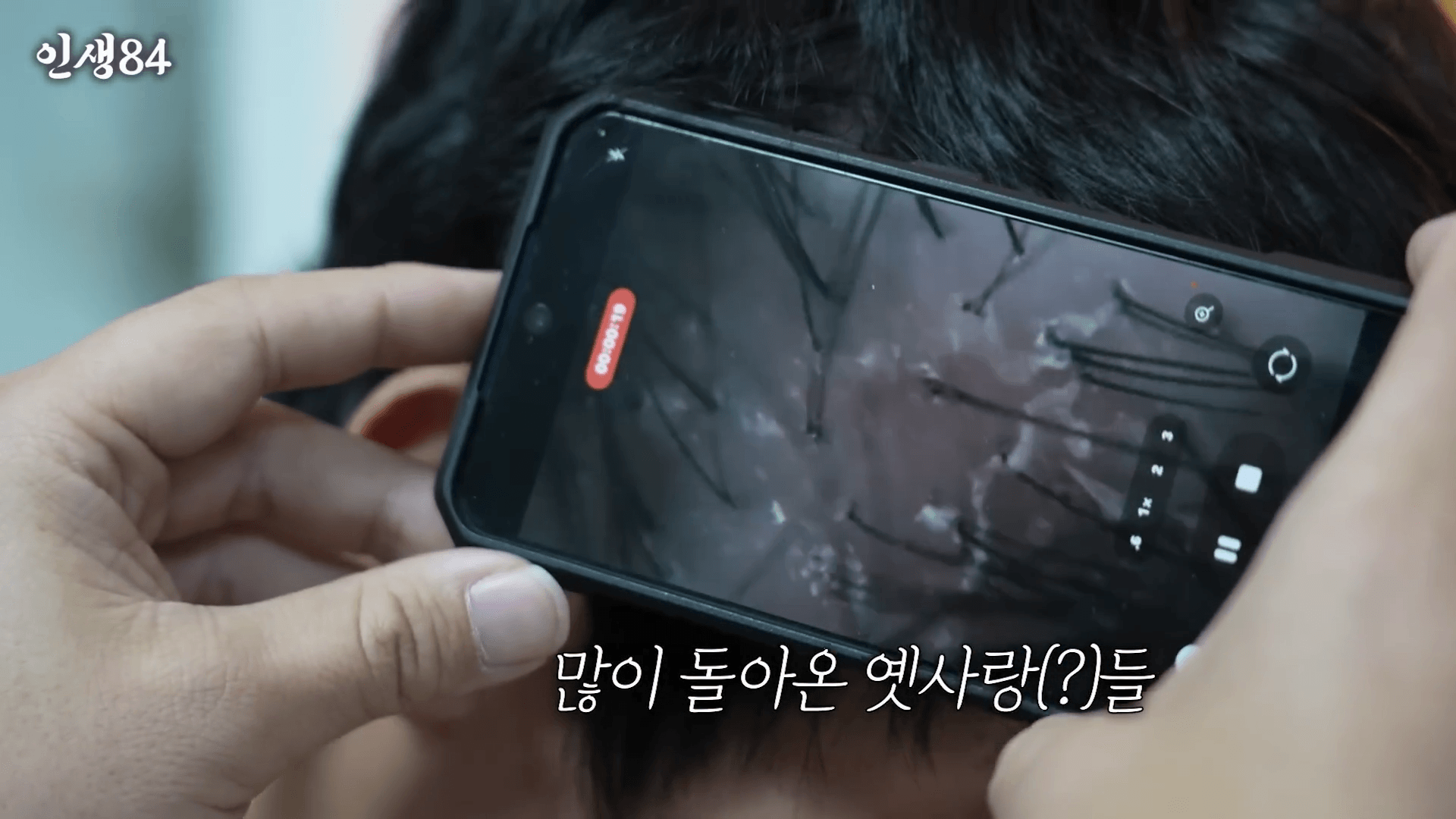 닥터그루트 지루성 두피 샴푸