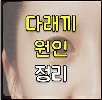 다래끼 치료 1