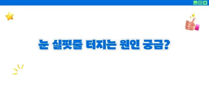 눈 실핏줄이 터지는 이유 총정리 (+예방방법)