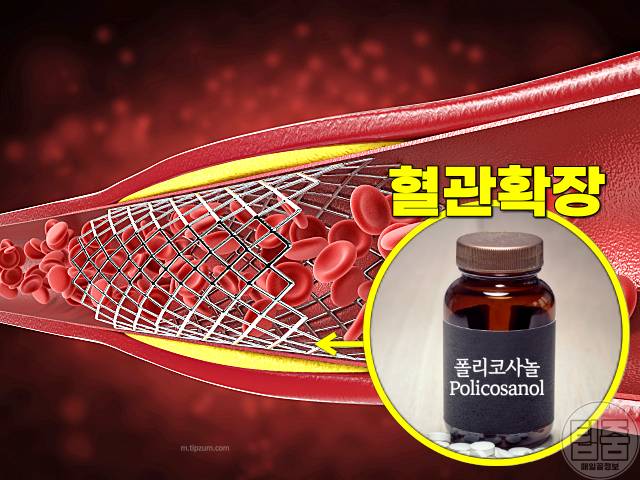 혈압 낮추는 영양제 고혈압영양제 추천 폴리코사놀