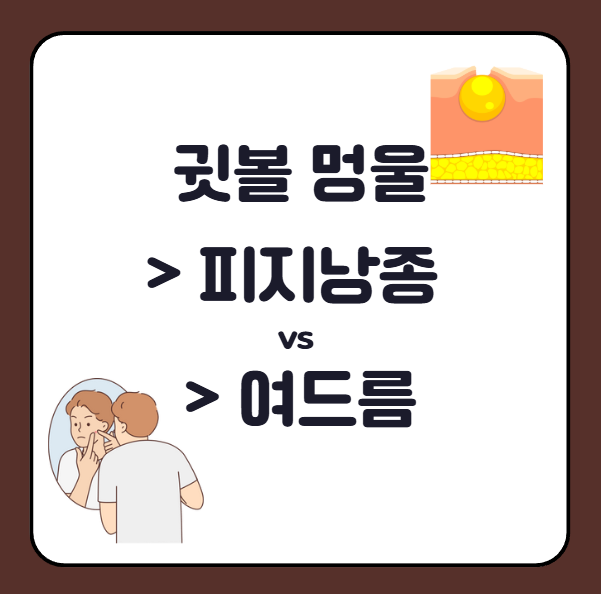 귓볼 멍울 피지낭종 vs 여드름 차이