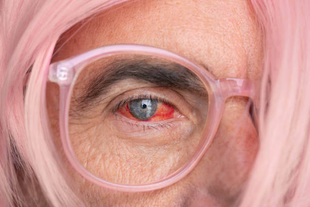 눈 실핏줄 터짐 원인 9가지 및 치료방법. 눈 실핏줄 터짐&amp;#44; 눈의 조직과 혈관의 손상으로 인해 발생하는 현상으로&amp;#44; 여러 요인에 의해 유발될 수 있습니다. 이 문제는 안구 건강을 반영하며&amp;#44; 원인을 파악하고 적절한 치료 및 예방책을 찾는 것이 중요합니다.