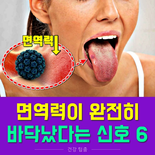 면역력이 떨어졌을때 증상 혓바늘 혀염증 대상포진 면역력 저하 증상, 건강 팁줌 매일꿀정보