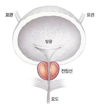방광염의 원인과 위험요인