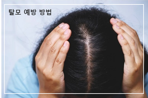 탈모 예방 방법 알아보고 예방