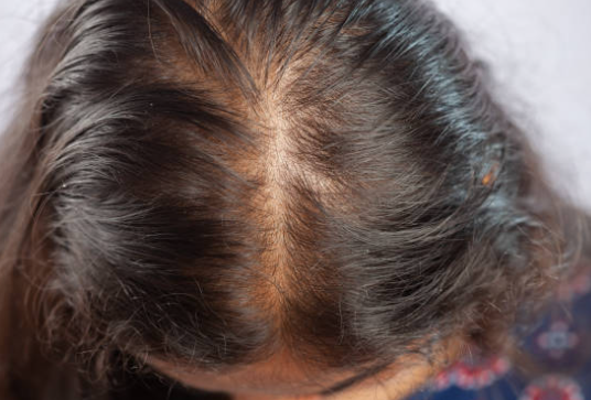 항암 시작 전, 탈모를 준비하며 내가 챙긴 것들