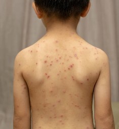 괴로워하는 우이 아이를 위해 빠른 치료가 필요합니다