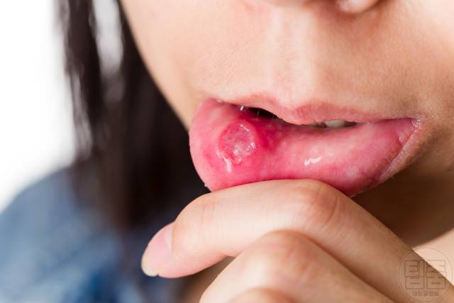 멜라토닌 부족 증상 면역력