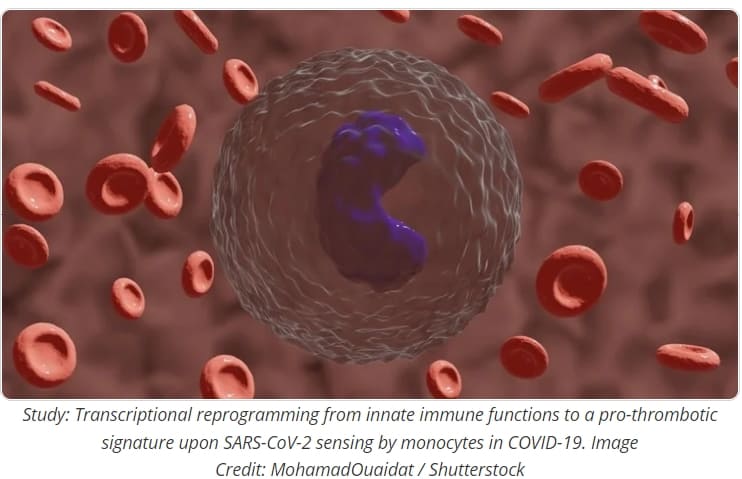 "코로나19, 면역세포도 감염시켜" Transcriptional reprogramming of monocytes in COVID-19