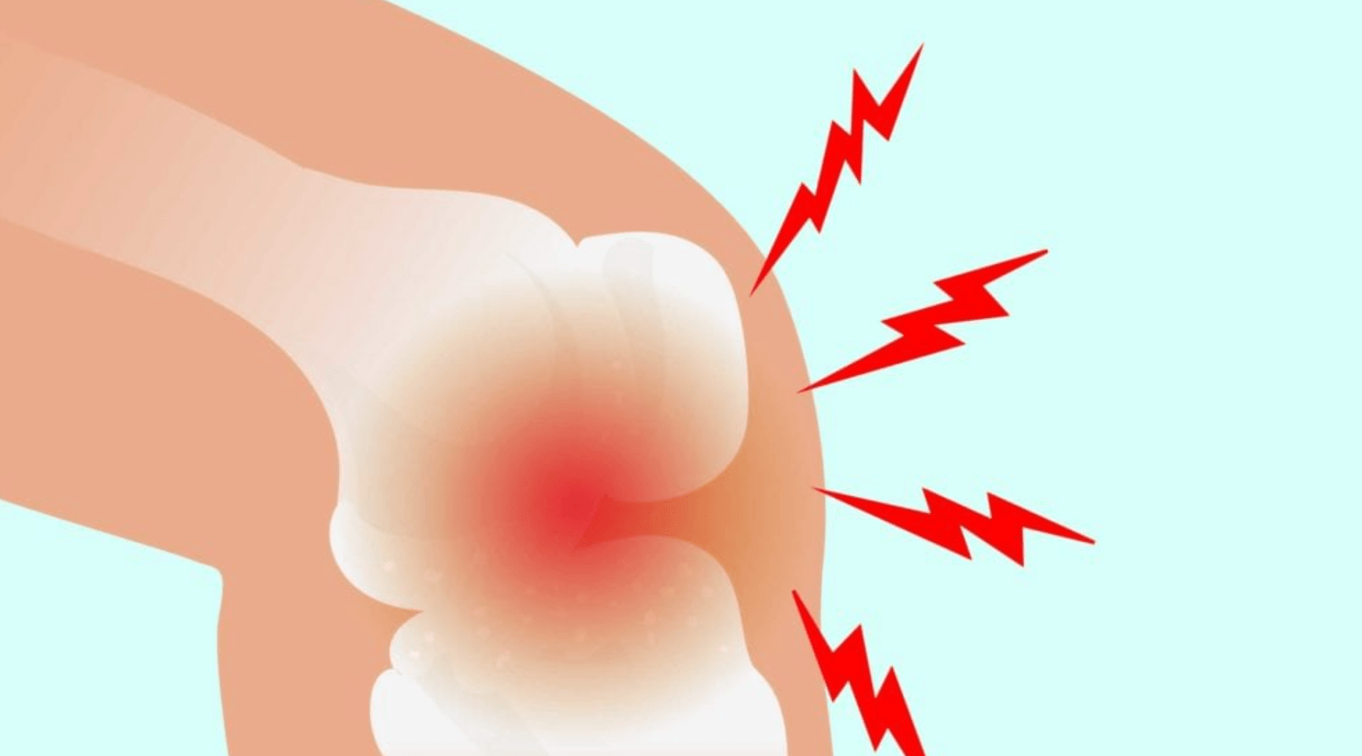 무릎 관절 치료