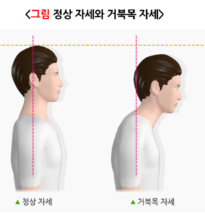 거북목자세
