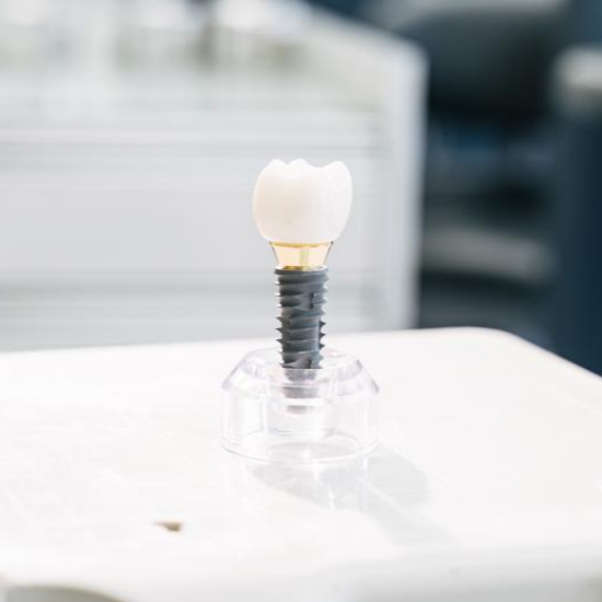 임플란트 시술과정 단계별 설명2