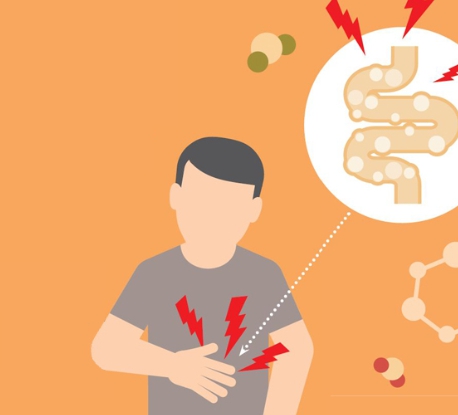 과민성대장증후군 (IBS)