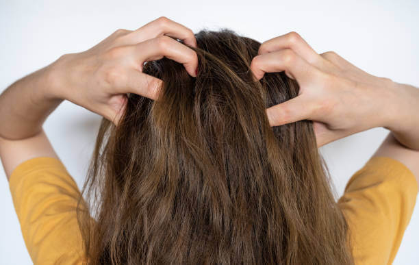 두피 환경 관점에서 본 트러블 발생의 근본 원인 정리