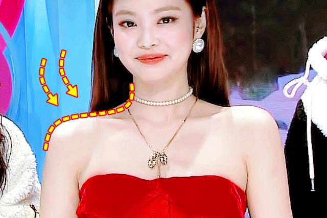 제니 직각어깨 만드는 운동, 승모근 통증 보톡스 담, 승모근 없애는 운동, 다이어트 팁줌 매일꿀정보