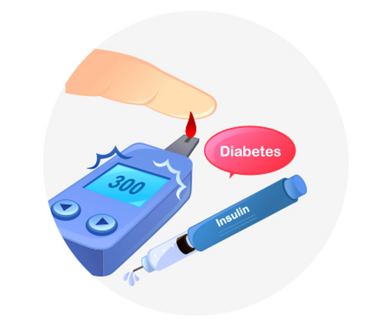 고혈당 쇼크 원인 증상 대처방법&amp;#44; 김수미 사망 사례 분석