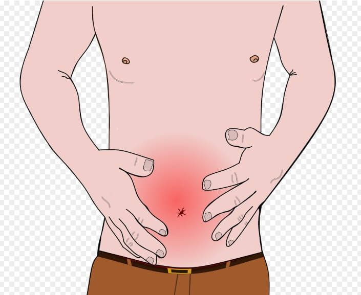 상위를 벗은 남성이 복부 통증을 느끼는 모습