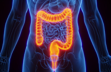 유산균 추천,프로바이오틱스