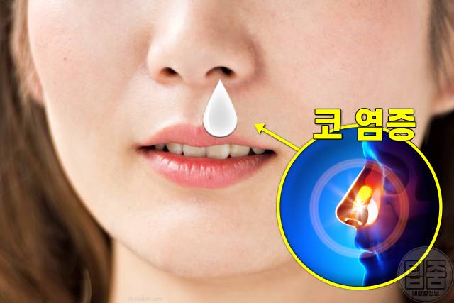 콧물 색깔별 증상,하얀 콧물 색깔로 보는 건강,비염