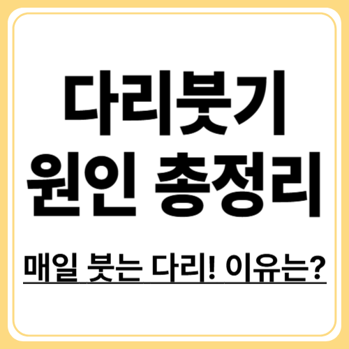 다리부종의 원인과 예방 방법! 다리부종을 일으키는 질환