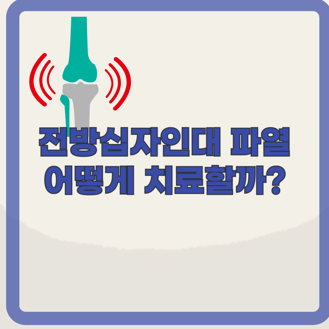 무릎에서 뚝 소리가? 전방 십자인대 파열의 증상 및 치료 알아보기