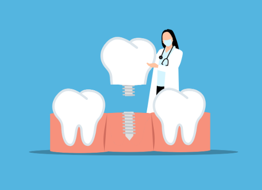 부산 임플란트 가격 싼곳 TOP3
