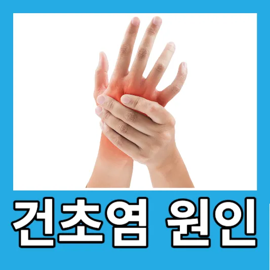 손목 건초염의 원인