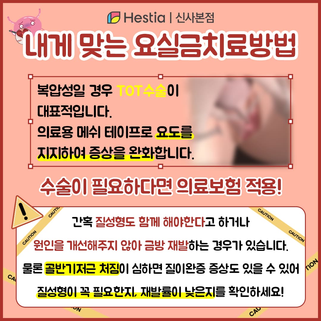 골반 운동 요실금치료방법 내게 맞는 요실금치료방법