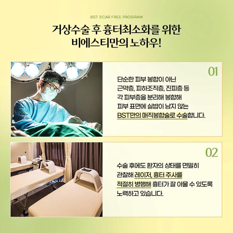 거상 수술 후 흉터최소화를 위한 비에스티만의 노하우