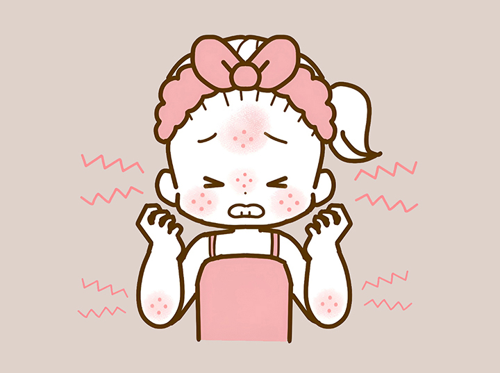 타히보로-알레르기가-생긴-여성
