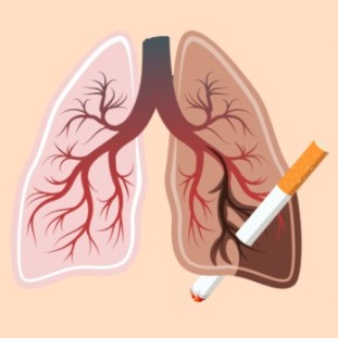 만성폐쇄성 폐질환의 주요원인인 담배 사진