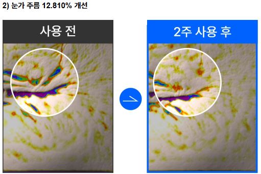 호주 주름크림 효과