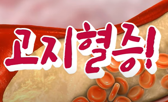 인슐린에 저항하는 지방세포