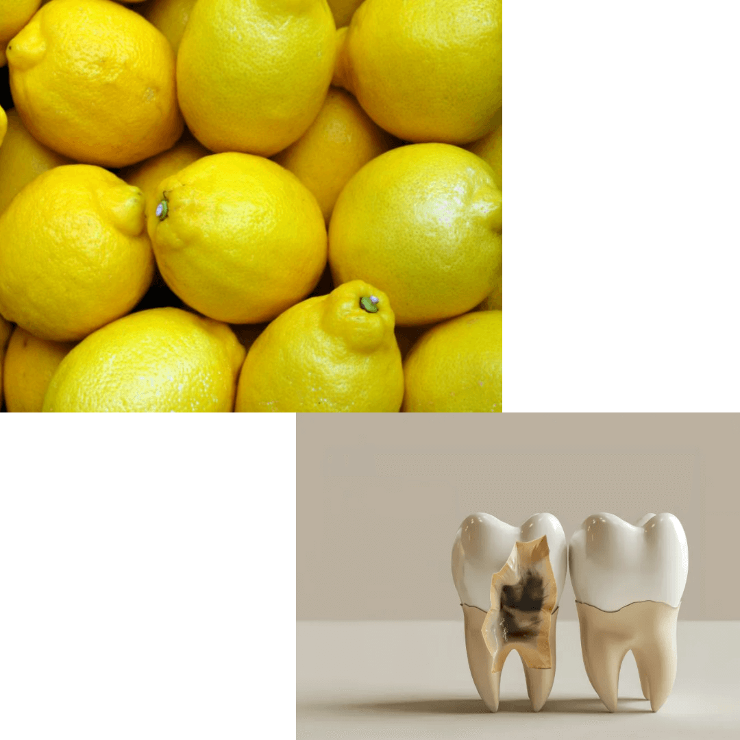 레몬과 치아부식