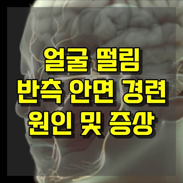 반측 안면 경련