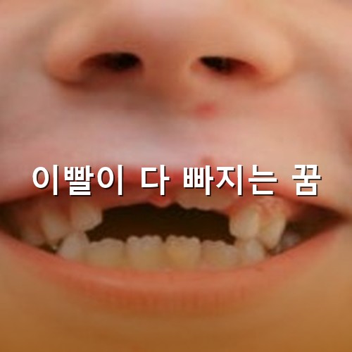 윗-이빨이-벌써-세개째-빠지고-있는-모습