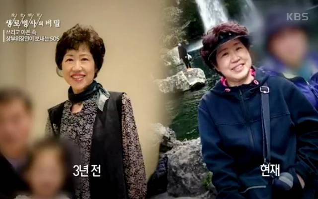 소화 안되고 트림 속쓰림 기능성소화불량 생로병사의비밀