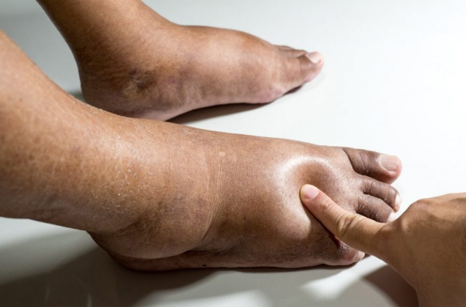 근육통이 보내는 질병 신호