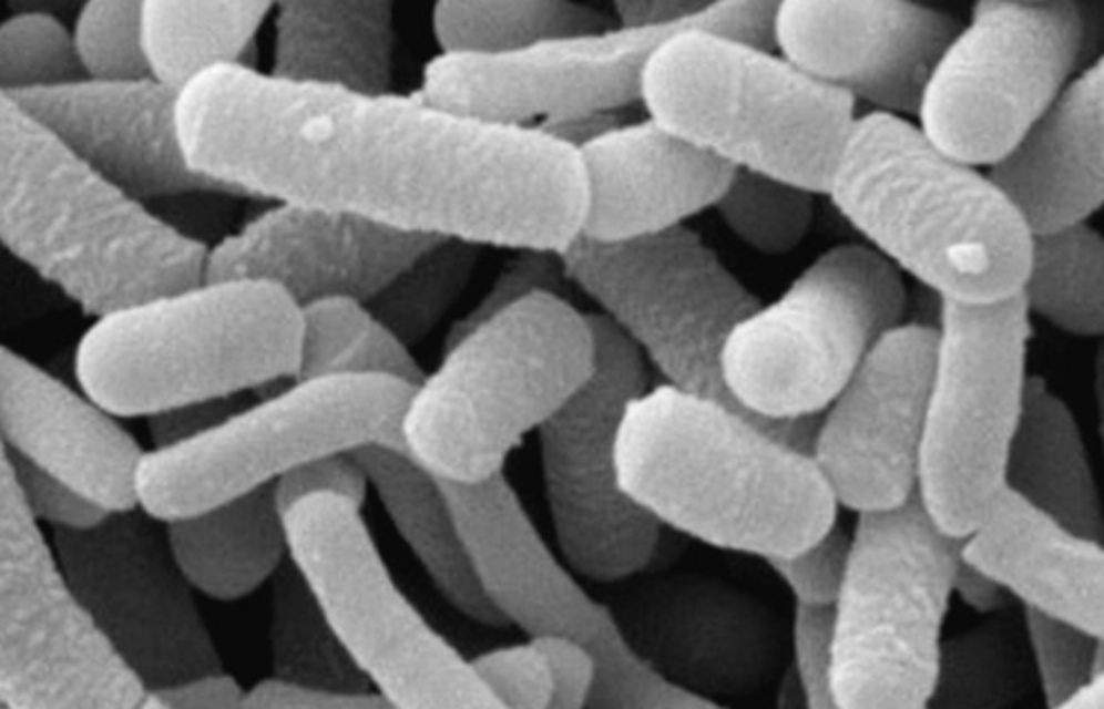 유산균-고르는방법