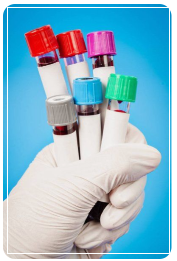 혈액검사 검체용기 색상