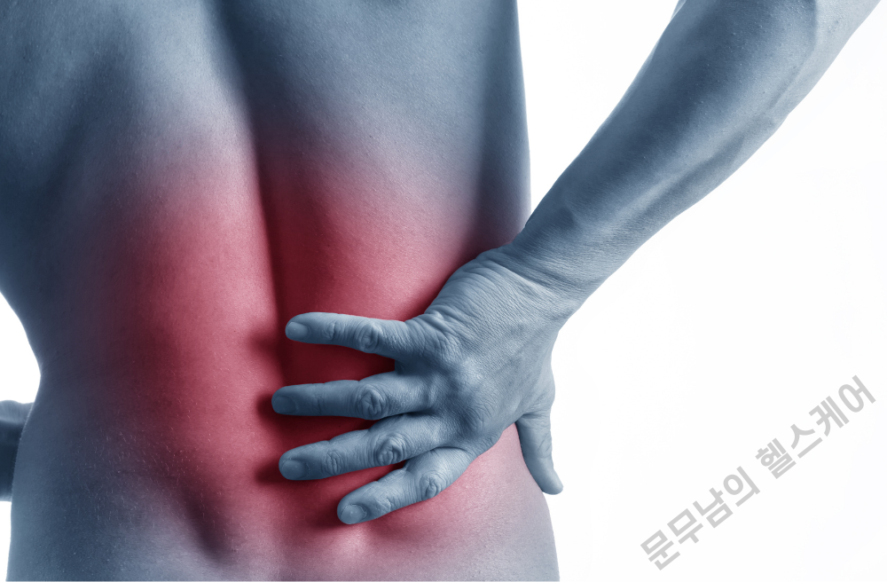 허리 인대 늘어났을때