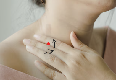 쇄골 위 최종 배출구 림프절