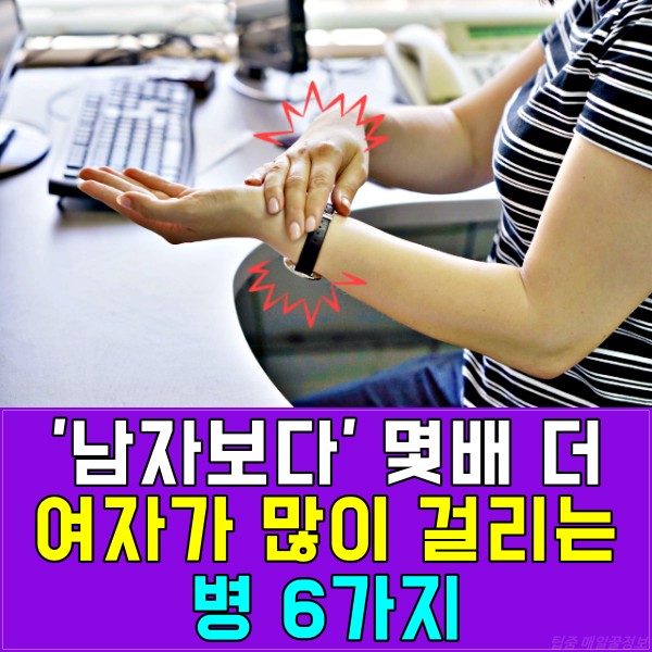 여자 다발성 경화증 원인, 건강 팁줌 매일꿀정보