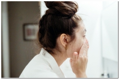 여드름 빨리없애는법