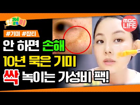 기미 없애는 방법