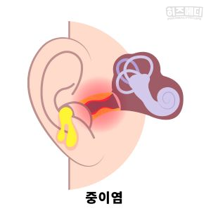 독감 인플루엔자 격리 치료